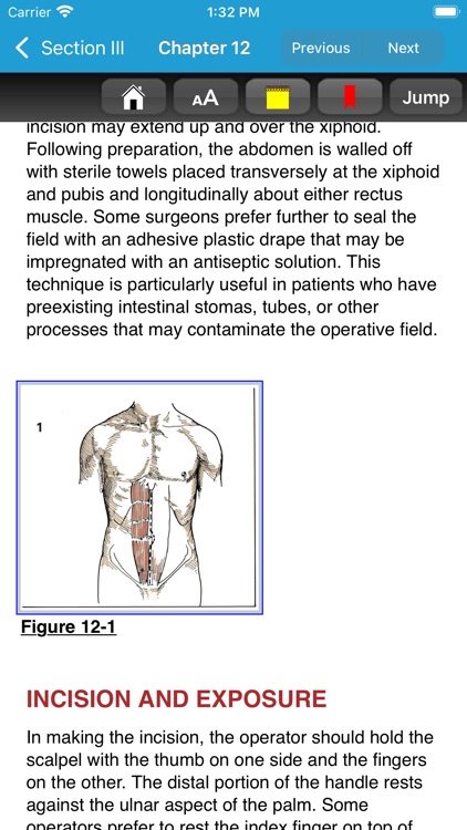 Zollinger Atlas of Surgery 11E screenshot-5