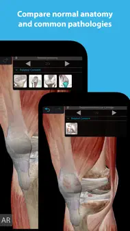 Muscles & Kinesiology iphone resimleri 2