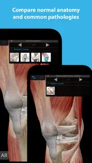 muscles & kinesiology iphone screenshot 2