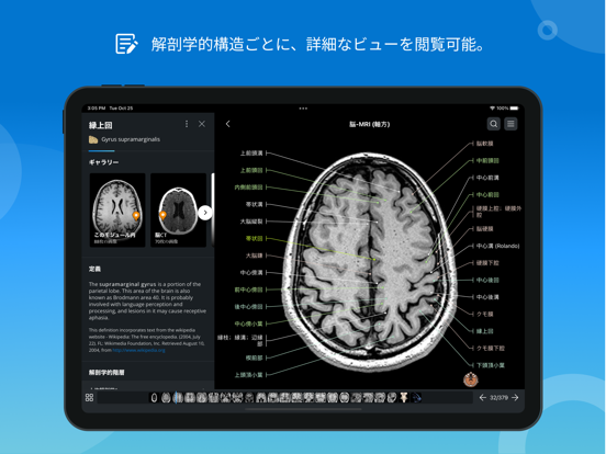 IMAIOS e-Anatomyのおすすめ画像5