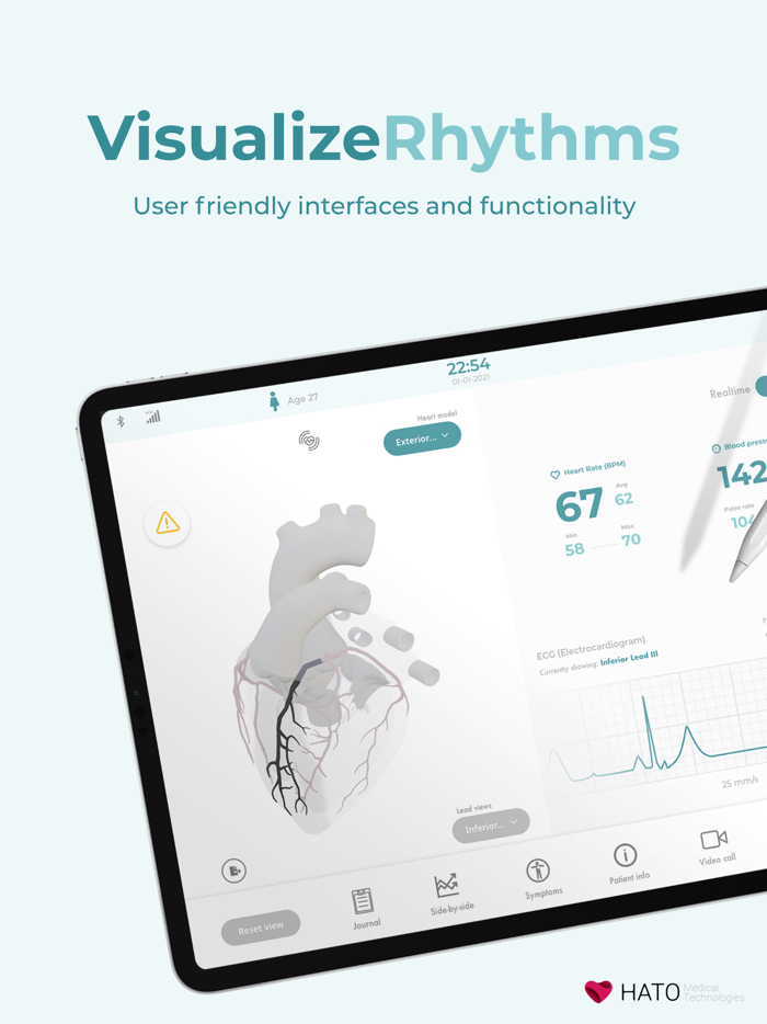 HATO Hub - ECG Education