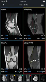 idv - imaios dicom viewer problems & solutions and troubleshooting guide - 1