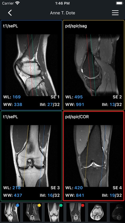 IDV - IMAIOS DICOM Viewer