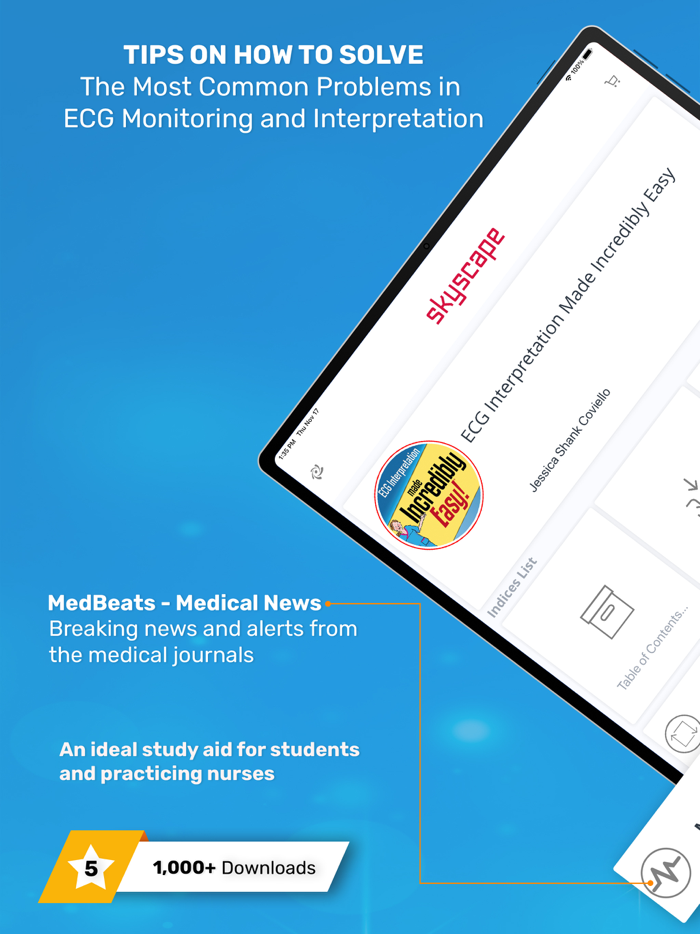 ECG Interpretation MIE