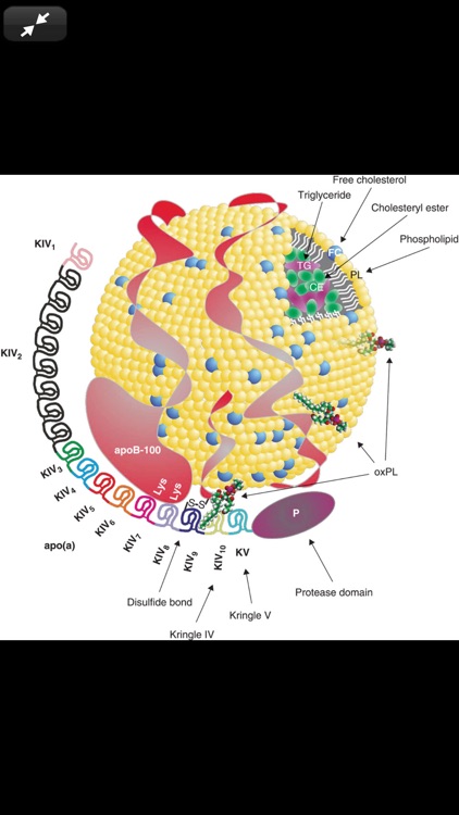 Fuster & Hurst's The Heart 15E screenshot-7