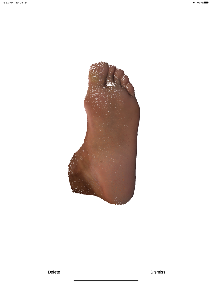 Orthera FootScan