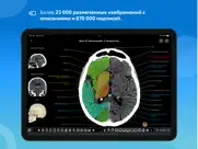 imaios e-anatomy айпад изображения 2