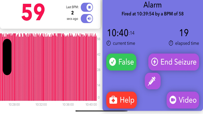 EPILEPSY RESEARCH KIT MirrorHR