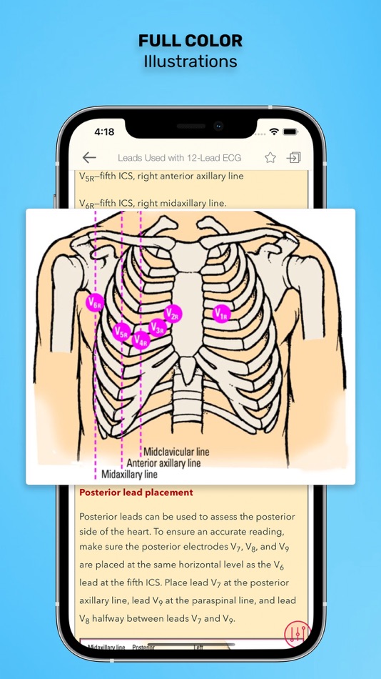 #3. ECG Interpretation: Pkt Guide (iOS) By: Skyscape Medpresso Inc
