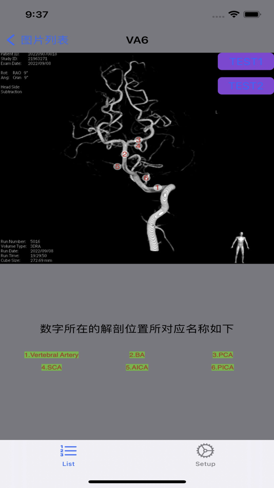 #9. 脑血管学习 (iOS) 게시자: 艺 张