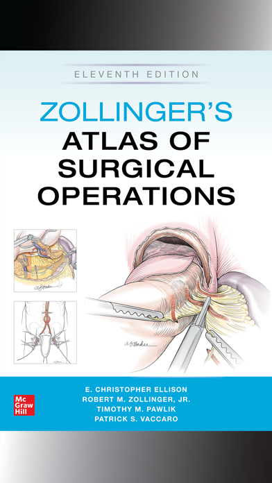 Zollinger Atlas of Surgery 11Eのおすすめ画像1