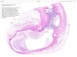 Game screenshot Appendiceal Pathology hack