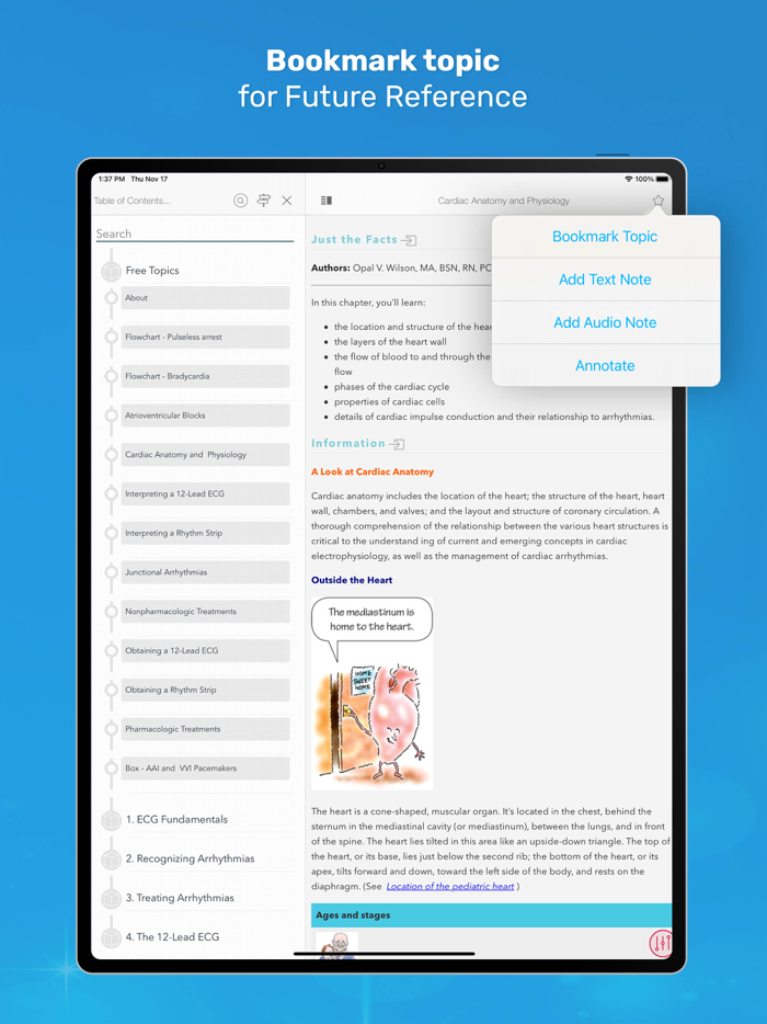 ECG Interpretation MIE
