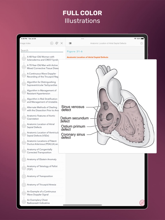 Screenshot #6 pour CURRENT Dx Tx Cardiology