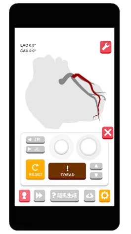 Game screenshot 冠脉造影模拟器 mod apk