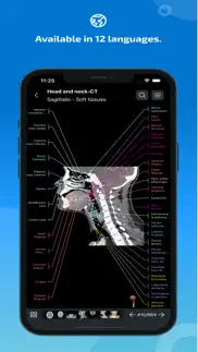 imaios e-anatomy problems & solutions and troubleshooting guide - 4