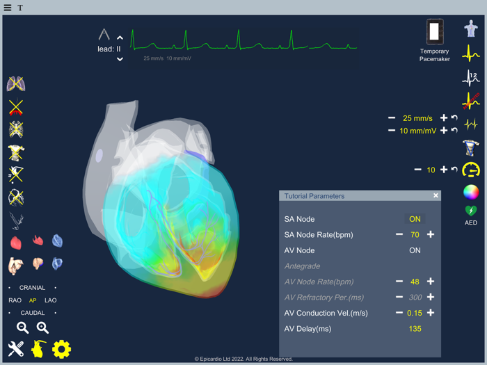 Epicardio Heart Simulator