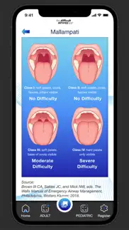 the difficult airway app problems & solutions and troubleshooting guide - 3