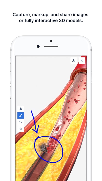 BioDigital Human - 3D Anatomy screenshot-4