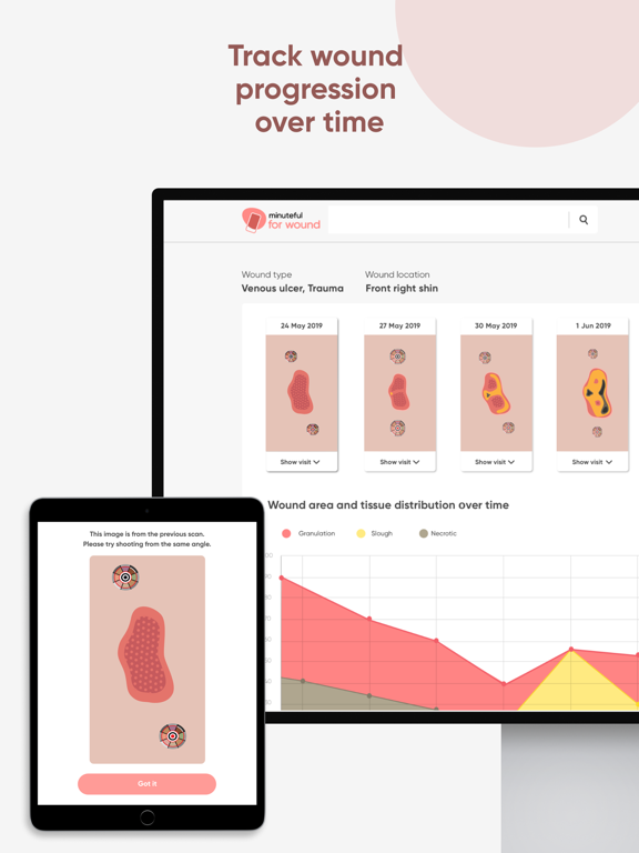 Minuteful for Wound iPad screenshot 4 - Medical app