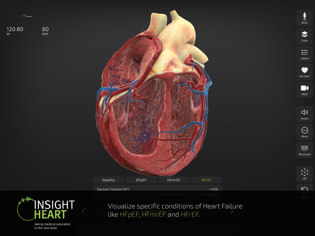 Captură de ecran INSIGHT HEART