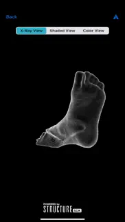 3dfootscan - structure sdk problems & solutions and troubleshooting guide - 4