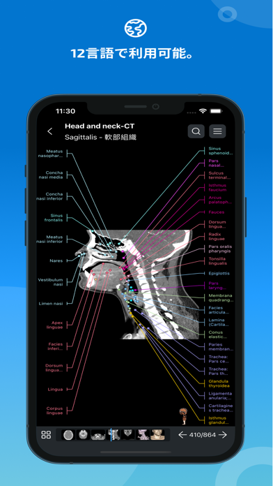 IMAIOS e-Anatomyスクリーンショット