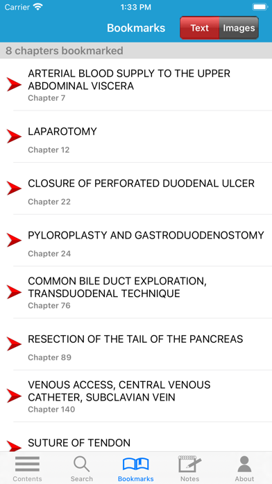 Zollinger Atlas of Surgery 11Eのおすすめ画像10