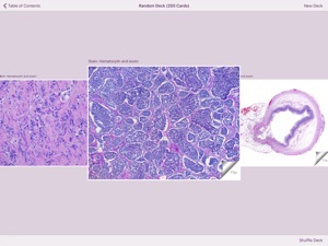 Appendiceal Pathology screenshot #5 for iPad