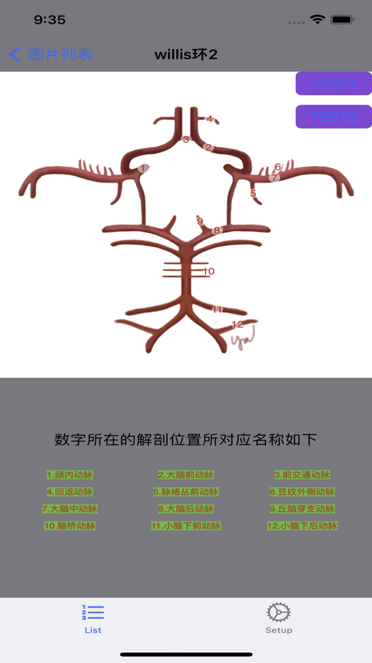 #3. 脑血管学习 (iOS) 게시자: 艺 张