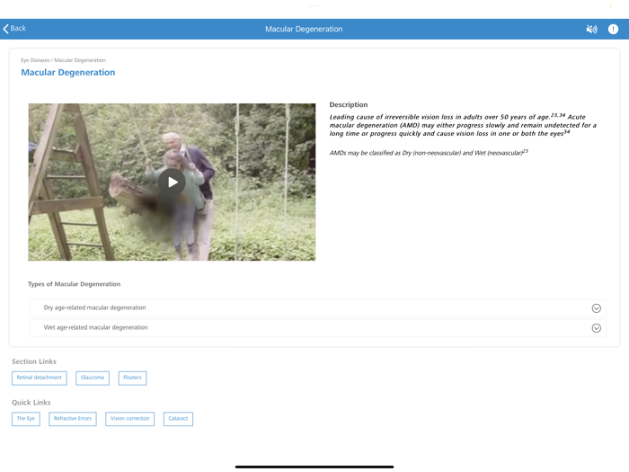 ZEISS Patient Counselling