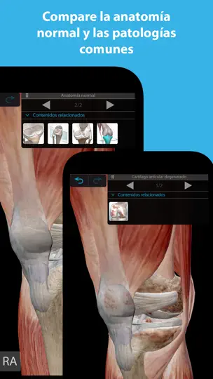 Captura de pantalla de Músculos & Kinesiología en iPhone 2
