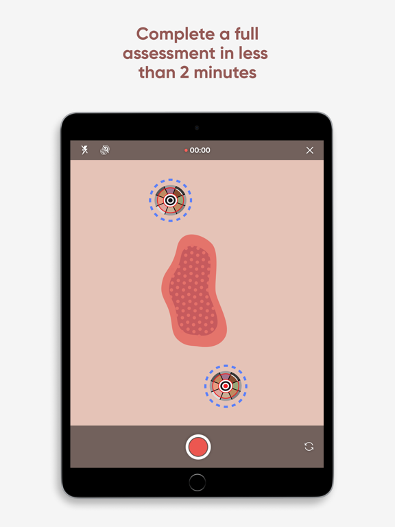 Screenshot #6 pour Minuteful for Wound