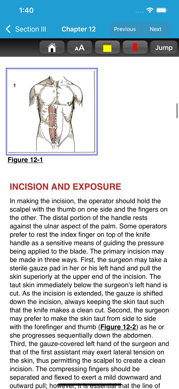 Zollinger Atlas of Surgery 11E screenshot 6