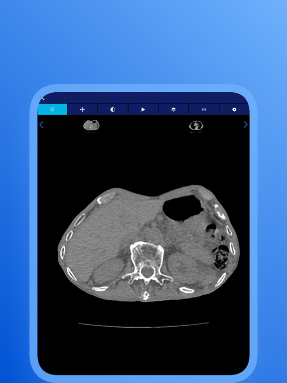 Screenshot #6 pour Mobilemed Telerradiologia
