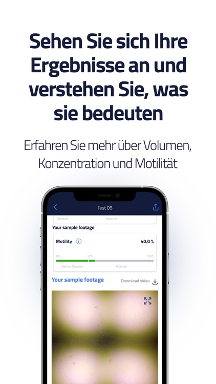 ExSeed: Spermiengesundheit