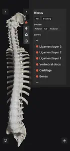 Biomechanics of the Spine Lite screenshot #1 for iPhone