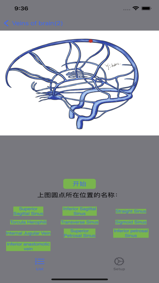 #6. 脑血管学习 (iOS) 게시자: 艺 张
