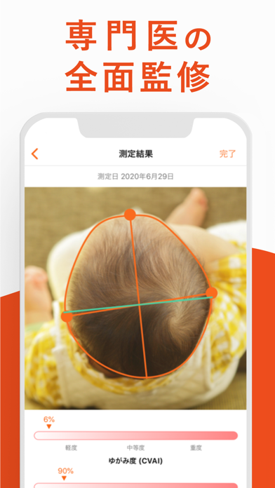 赤ちゃんの頭のかたち測定 Screenshot