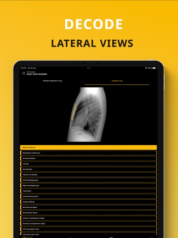 Chest X-ray Academy: Learn CXRのおすすめ画像7