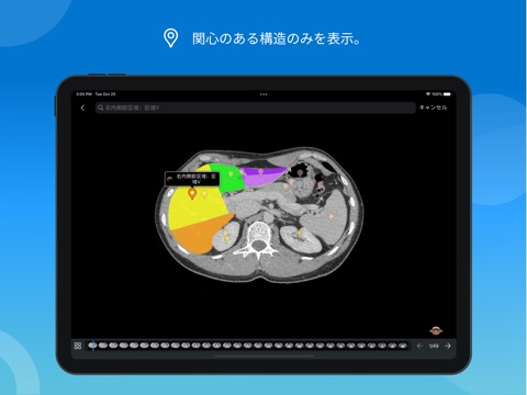 IMAIOS e-Anatomyのおすすめ画像4