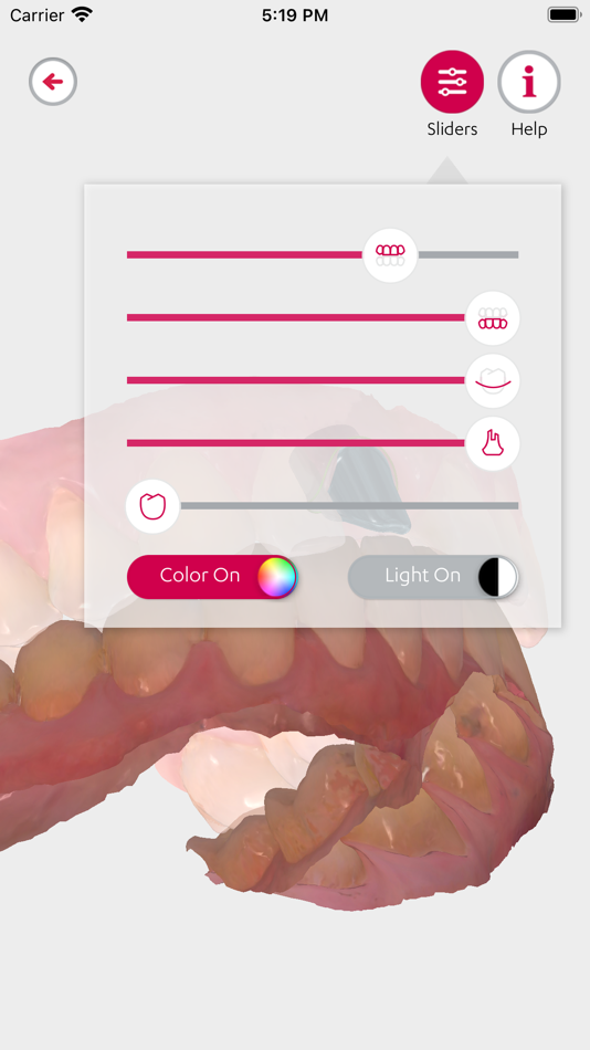 #2. 3Shape Communicate (iOS) 由: 3Shape