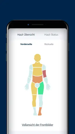 Game screenshot Neurodermitis App NALA mod apk