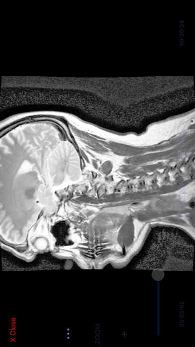 Mimic for Patients iPhone screenshot 7 - Medical app