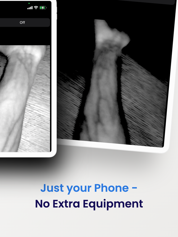 Screenshot #6 pour VeinSeek Pro