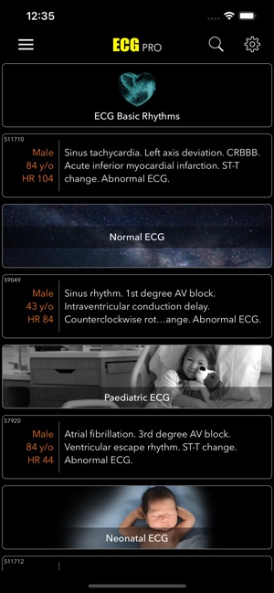 Free ecg app for apple watch top