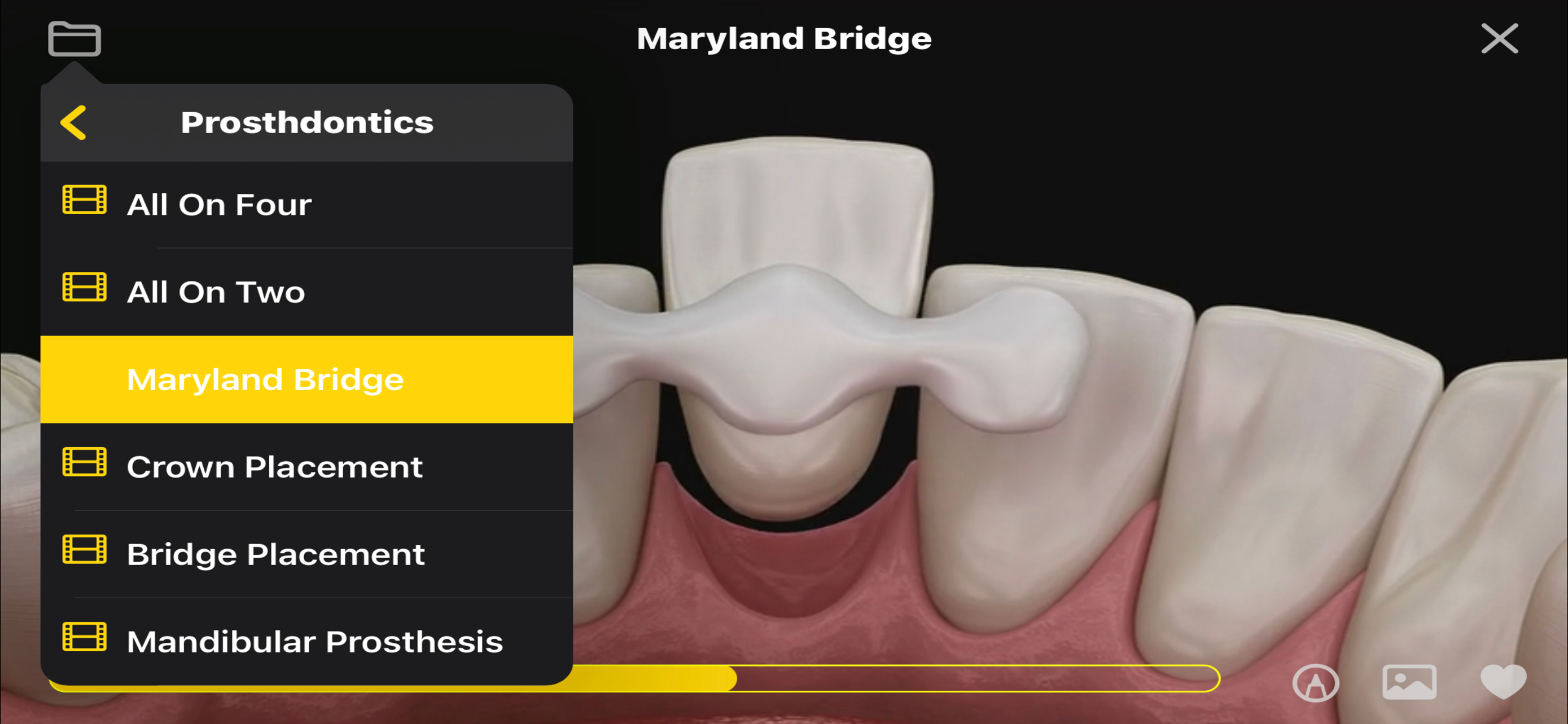 Dental Animations