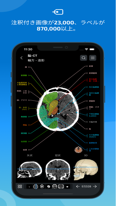 IMAIOS e-Anatomyのおすすめ画像2