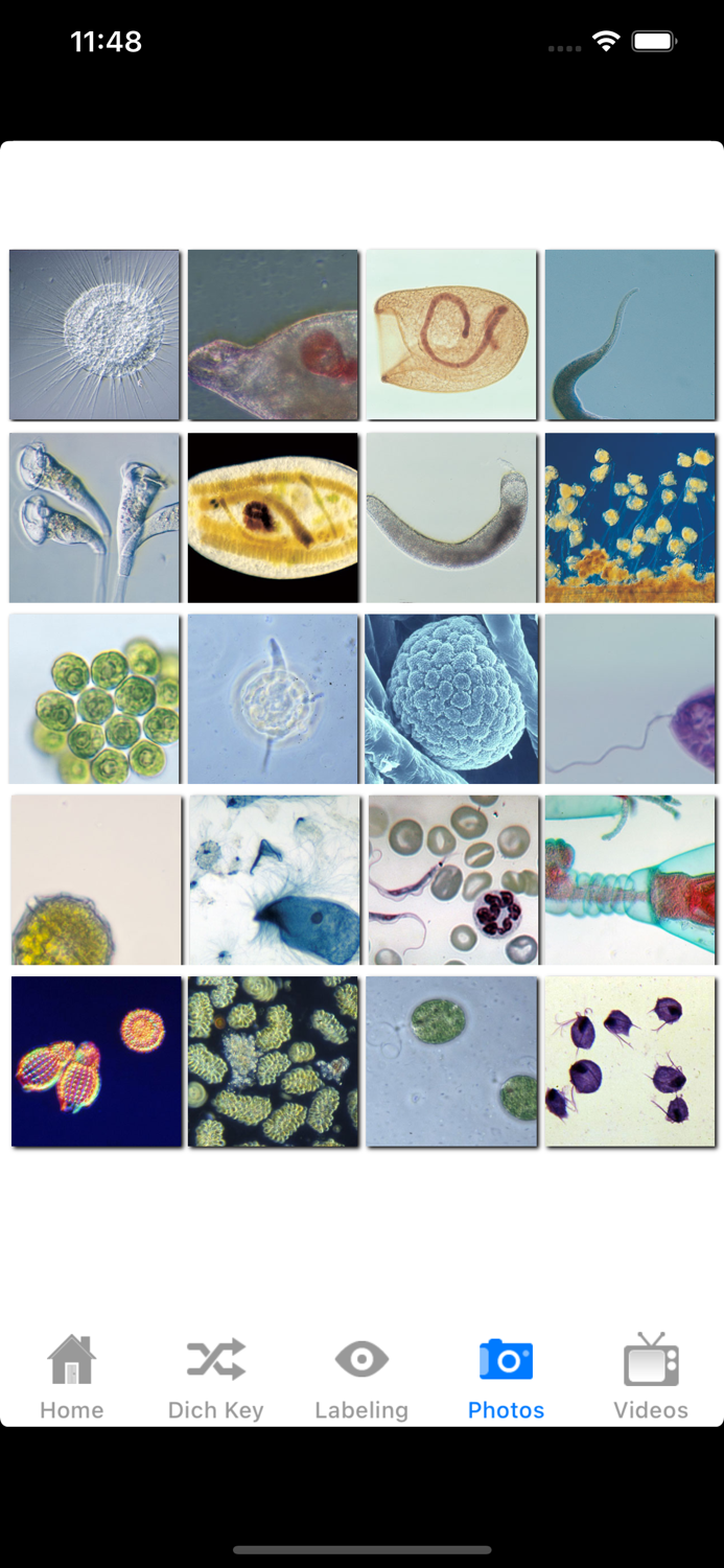 Protozoan Identification
