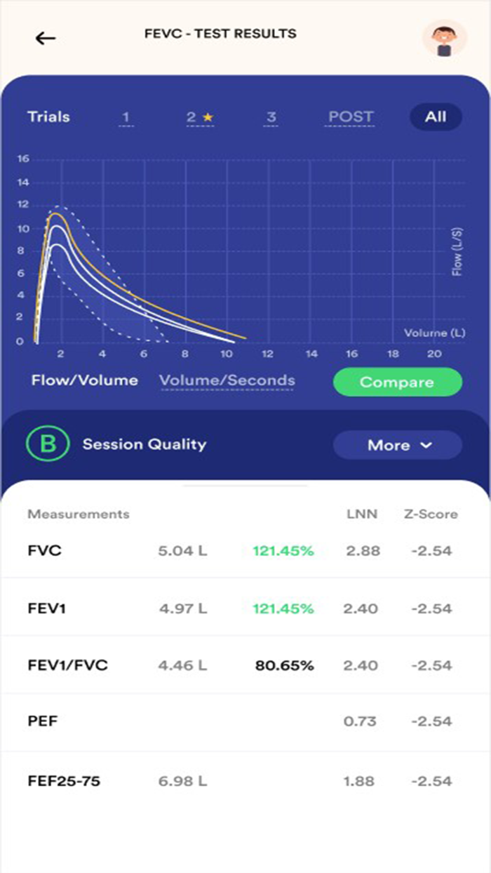 Safey Pocket Spirometer